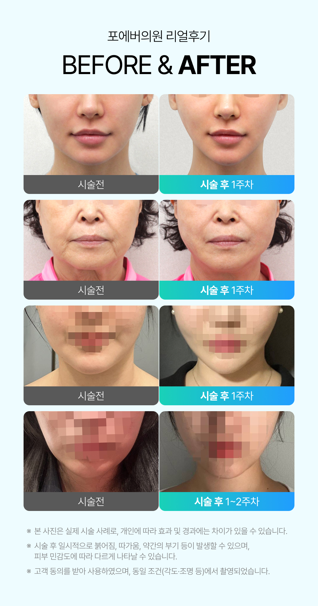 텐써마